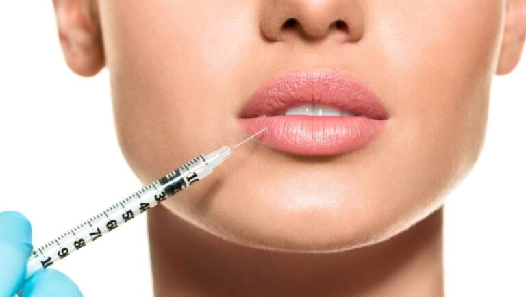 Lip Fillers: What You Should Know Before You Decide?